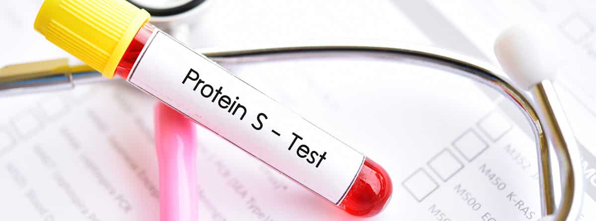 ¿Qué es la proteína S? muestra de sangre para realizar test de proteína S