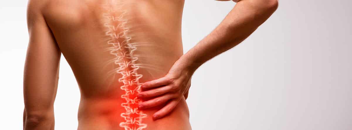 Síndrome facetario de columna vertebral: espalda de hombre con vista de columna vertebral y la mano puesta con sensación de dolor