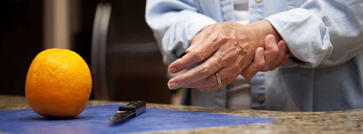 hobre mayor con artritis reumatoide en las manos