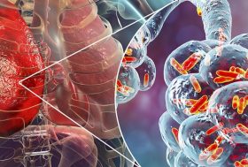 ¿Qué es la neumonía atípica?: Dibujo de ser humano con infección en los pulmones