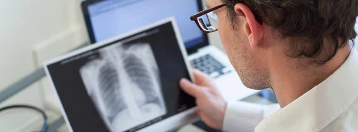 Neumonía atípica: médico revisando una radiografía de los pulmones