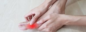 Enfermedades que afectan al dedo del pie: manos de mujer sobre el juanete enrojecido