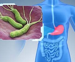 ¿Qué es el helicobacter pylori y cómo se trata: ilustración de la bacteria de helicobacter pylori