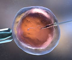 Tipos de reproducción asistida: ilustración de Inseminación artificial o fecundación in vitro