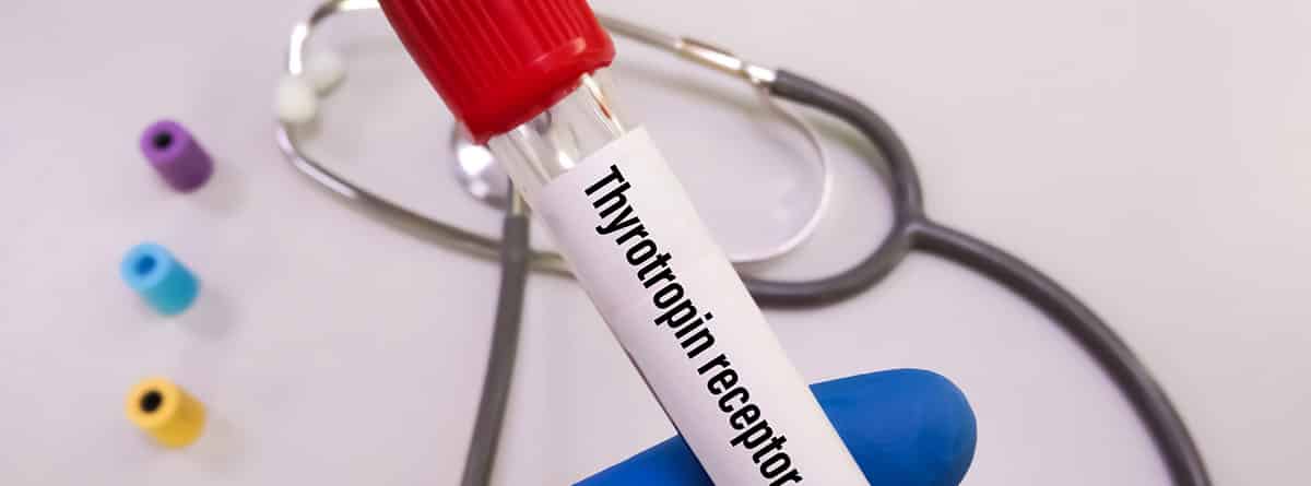 Causas de enfermedades de la hormona tiroidea: muestra en tubo de ensayo de la TSH