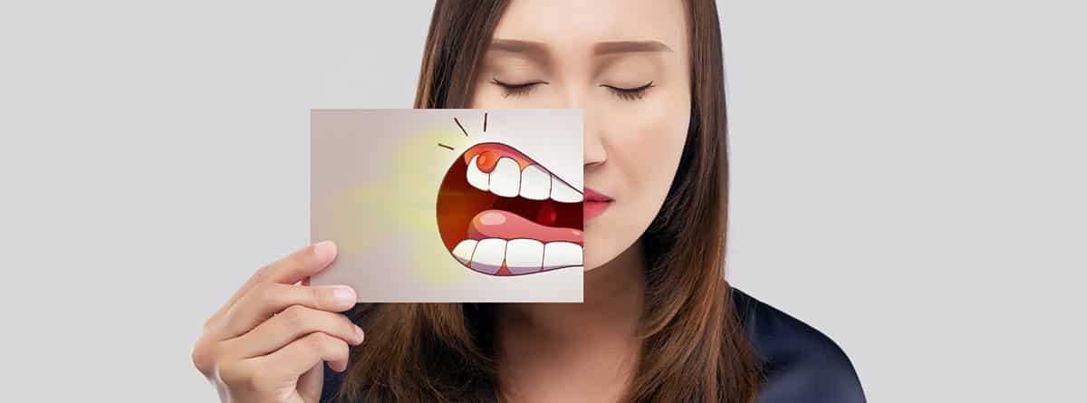Gingivitis: mujer sosteniendo un papel con la caricatura periodontal y de gingivitis de su boca contra el fondo gris