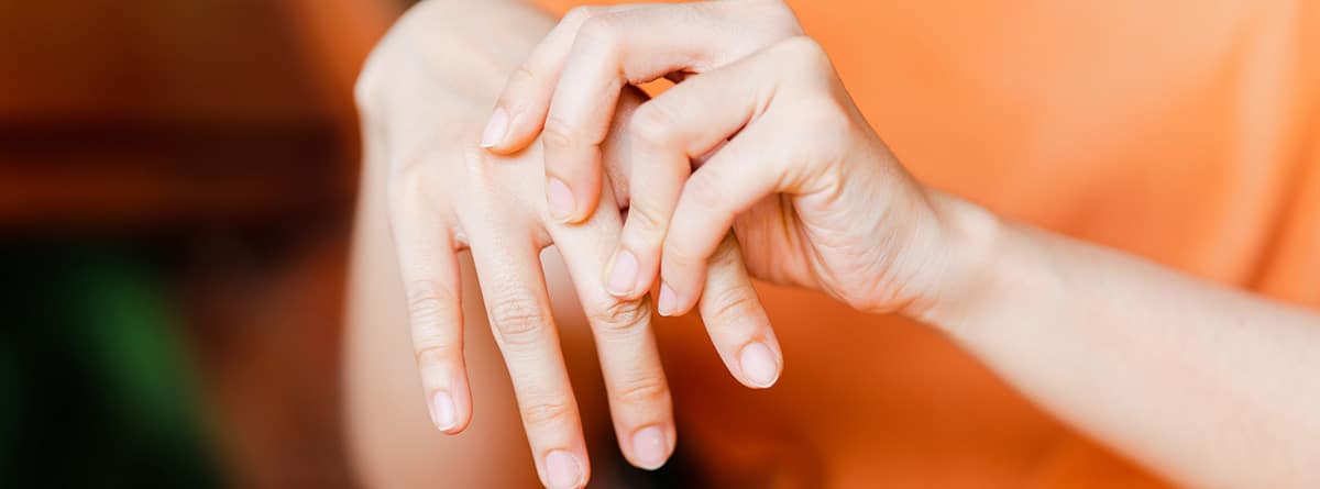 manos de mujer con artritis