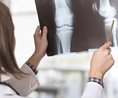 Fractura y fisura ósea: Joven doctora mirando la imagen de rayos X de una lesión en la rodilla en un hospital