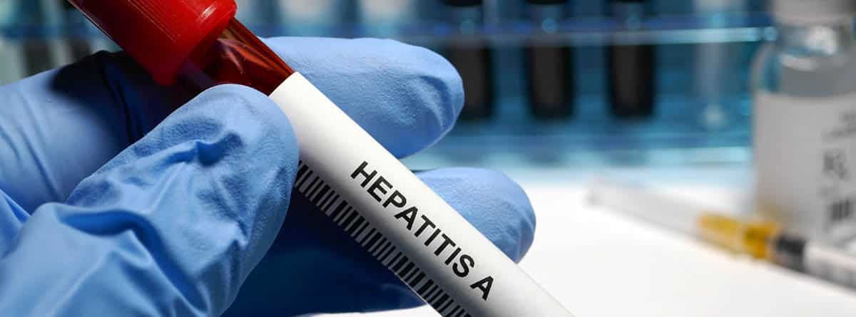 Hepatitis A: tubo de ensayo con sangre y una pegatina de hepatitis A