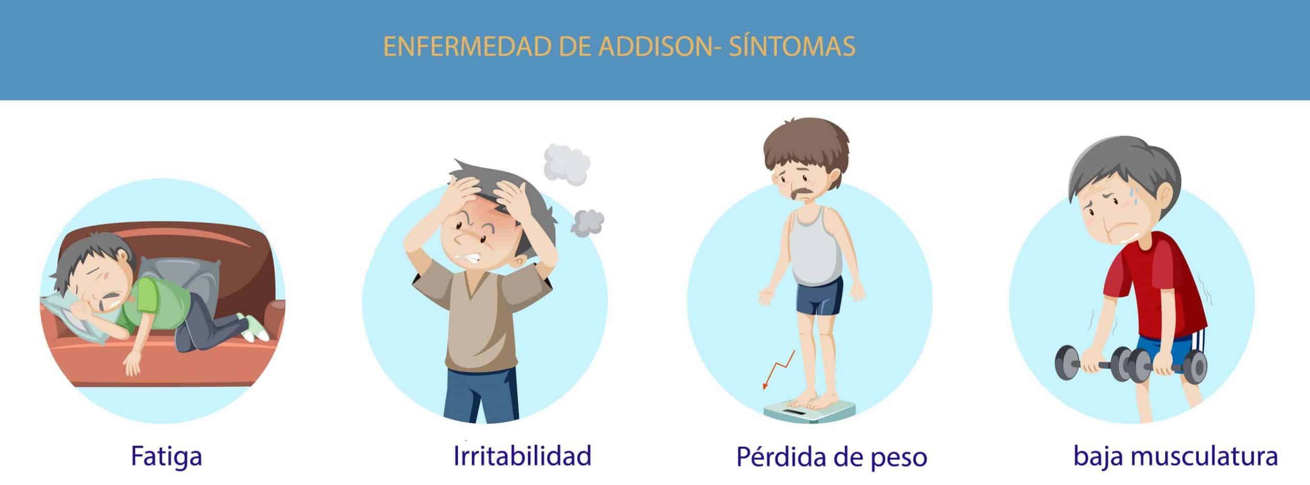 Síntomas de la enfermedad de Addison