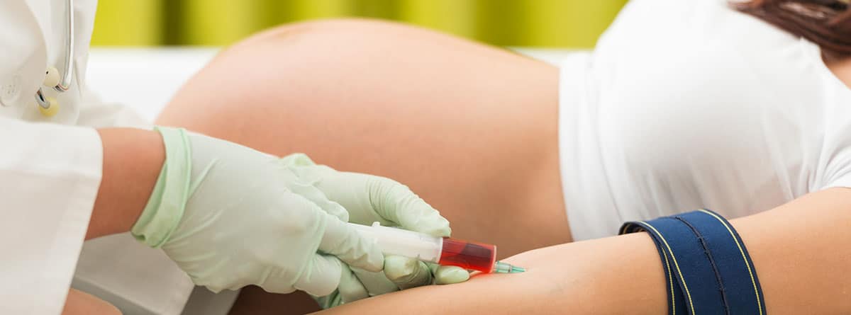 Incompatibilidad rh en el embarazo: análosos de sangre en una mujer embarazada