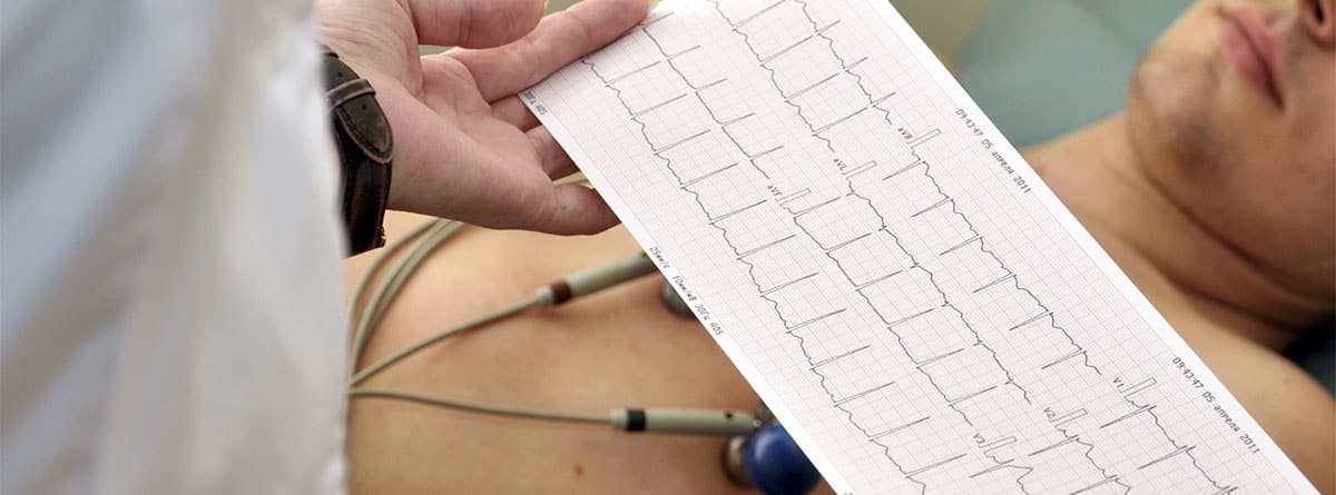 Persona realizándose un electrocardiograma