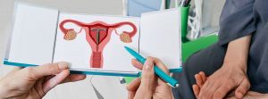Ginecólogo experimentado que muestra a una paciente un dispositivo anticonceptivo intrauterino , DIU