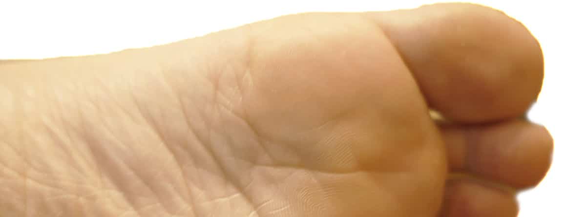 Presentación de diapositivas Cómo cortar las uñas de los pies engrosadas   Mayo Clinic