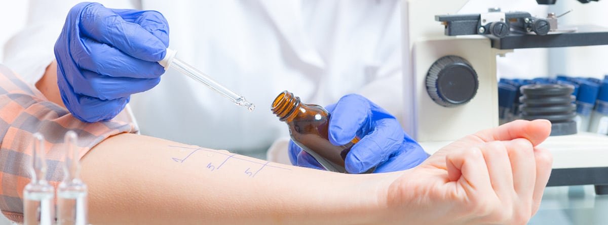 Prick test: especialista echando una gota de un alergeno en el brazo de un paciente