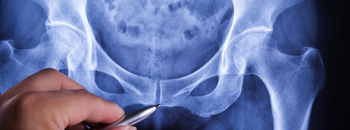 Suelo pélvico en hombres: radiografía de la pelvis de hombre