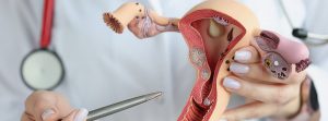 Clotoromegalia: doctor con una maqueta de los organos reproductores femeninos