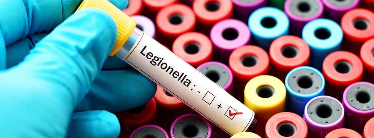 ¿A qué temperatura muere la legionella? Muestra de sangre positiva con legionella