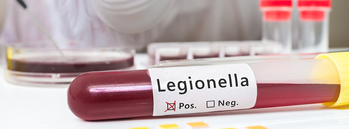 Legionella: Legionella en tubo de ensayo con sangre.