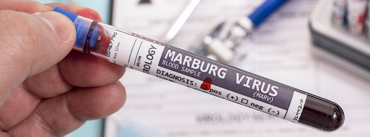 Virus marburgo: Muestras de sangre ficticias con virus marburg infectado, con estetoscopio, máscara y jeringa