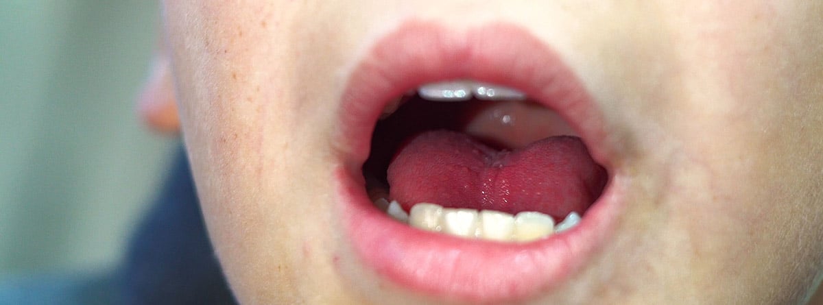 Dolor en la lengua, causas y soluciones: chico con la boca abierta, lengua roja y labios rojos