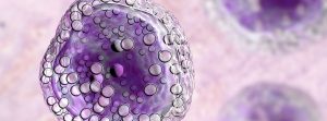 Linfoma de Burkitt, síntomas y esperanza de vida: ilustración de células de linfoma de Burkitt, es un cáncer del sistema linfático
