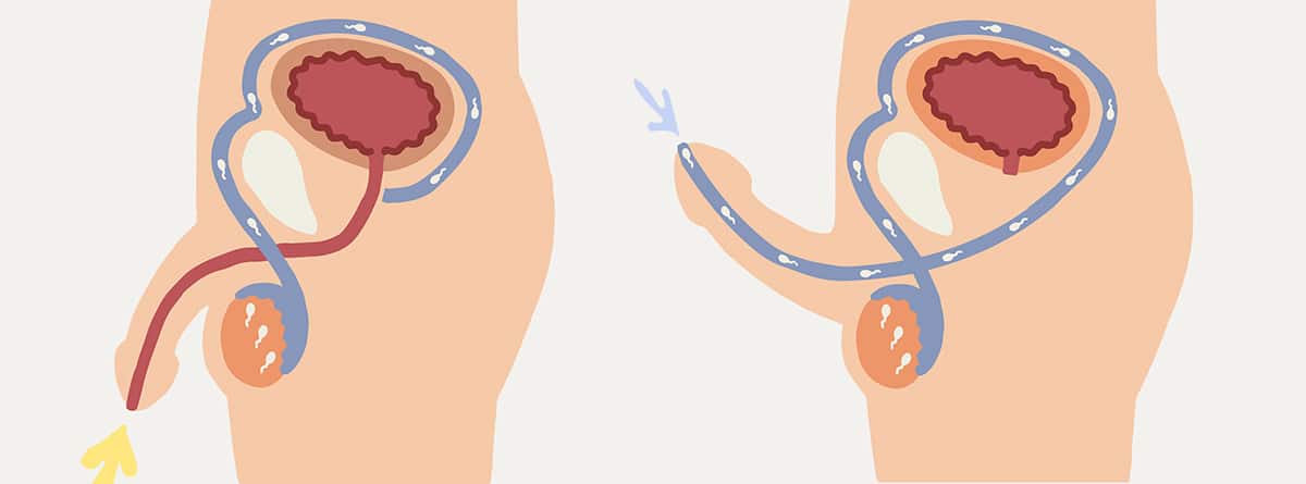 Orgasmo seco: ilustración Genitales masculinos Cómo funciona la eyaculación 