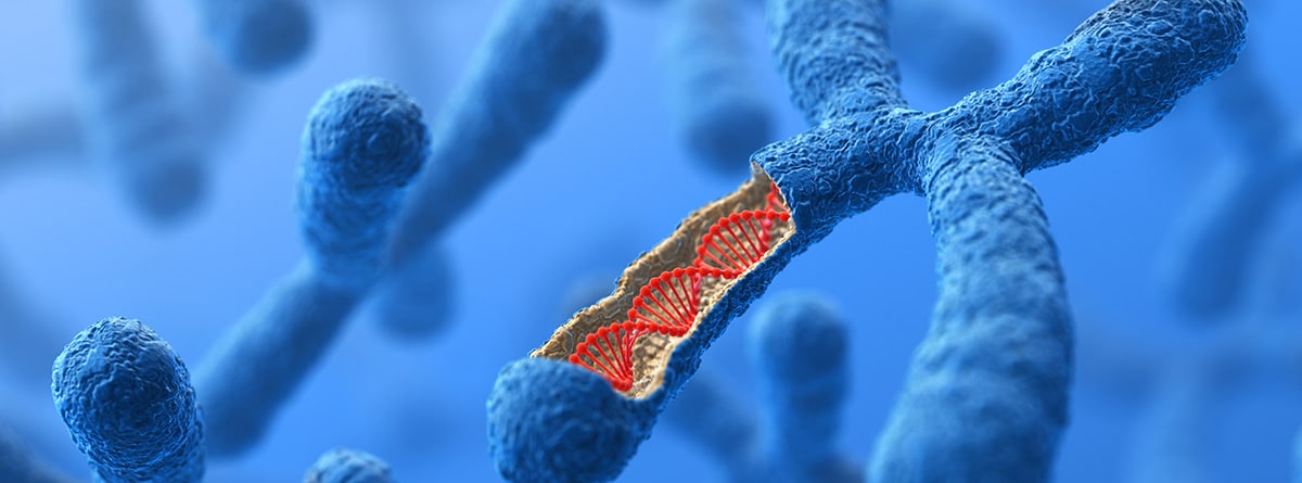 Síndrome de smith magenis: cromosoma alterado