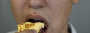 ¿Cómo afecta al acné la alimentación?: chico con acné en la cara comiendo un trozo de tarta