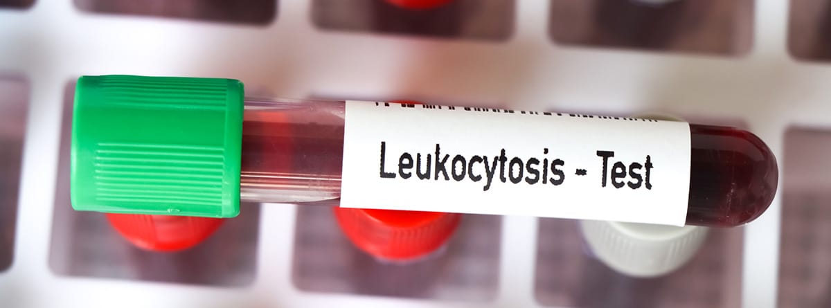 Enfermedades que provocan los leucocitos altos: test de leucocitosis en tubo de ensayo
