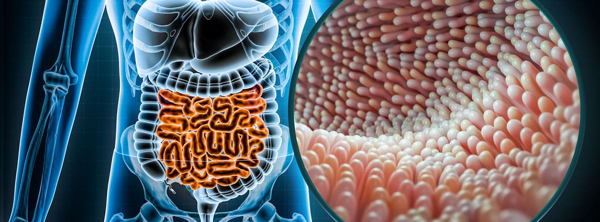 Paniculitis mesentérica: tracto intestinal del aparato digestivo humano