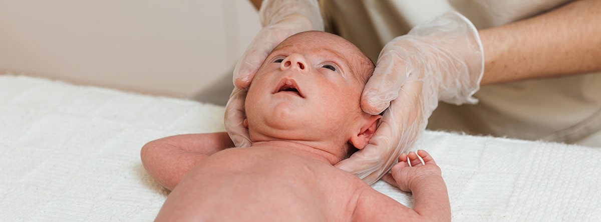 Plagiocefalia: pediatra realizando ejercicios en la cabeza de un bebé