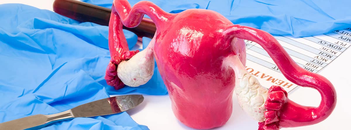 Histerectomia: Modelo de útero y ovarios cerca de bisturí, guantes quirúrgicos y tubo de análisis de sangre con resultado de sangre.