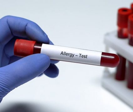 Test para detectar el S ndrome de Down canalSALUD