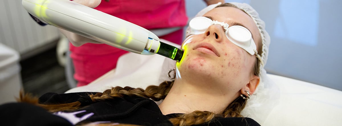 Dermatólogo en clínica de belleza haciendo limpieza de la piel de la cara de un adolescente con espinillas