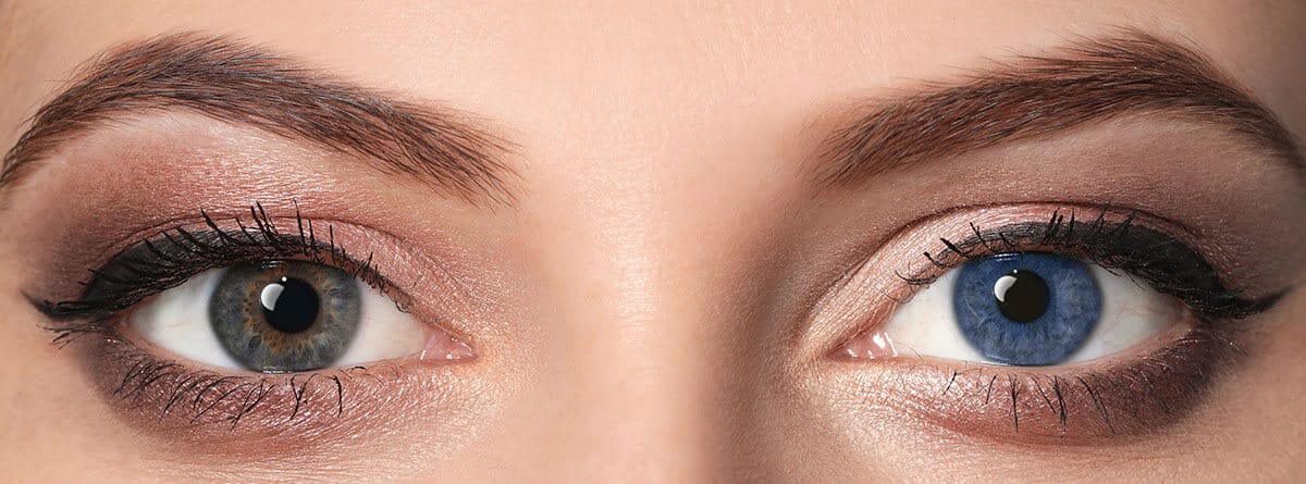 heterocromía: ojos de mujer de distinto color, uno marrón y otro azul