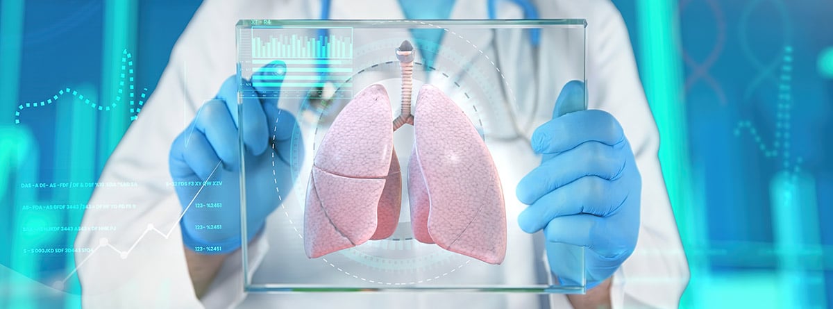 Toracocentesis: imagen de los pulmones