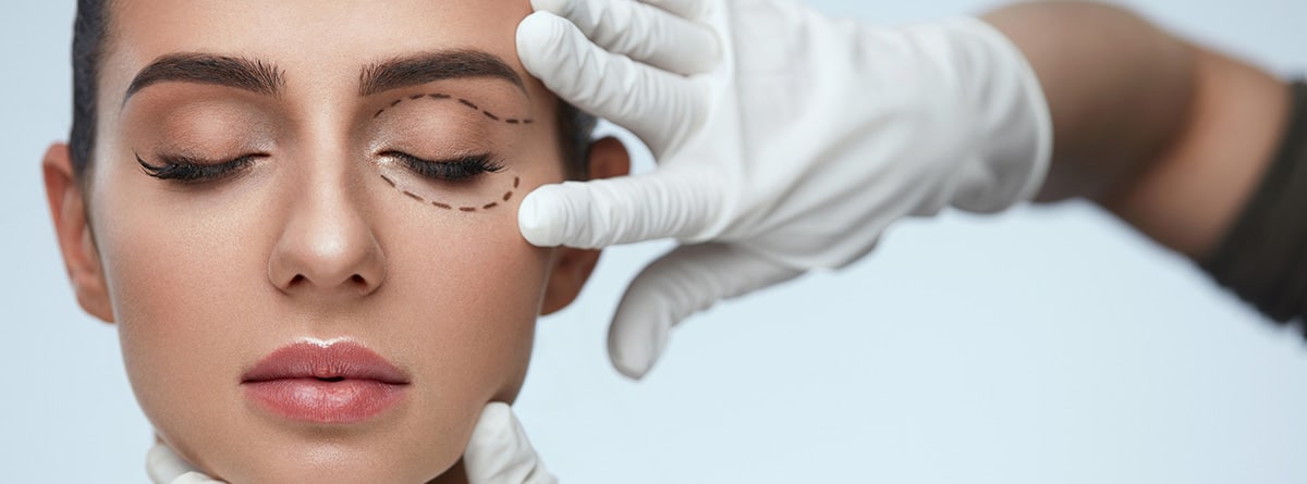 mujer con los ojos cerrados y líneas quirúrgicas negras en la piel, para preparación quirúrgica de párpados