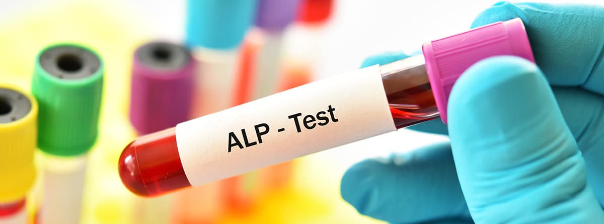 Tubo de muestra de sangre para prueba de ALP o enzima fosfatasa alcalina