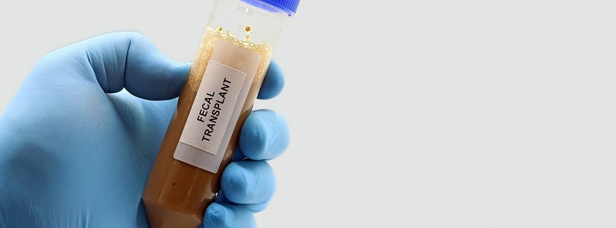 Trasplante fecal o trasplante de materia fecal (MFT). Un tubo de laboratorio con microbiota fecal para curar enfermedades digestivas 