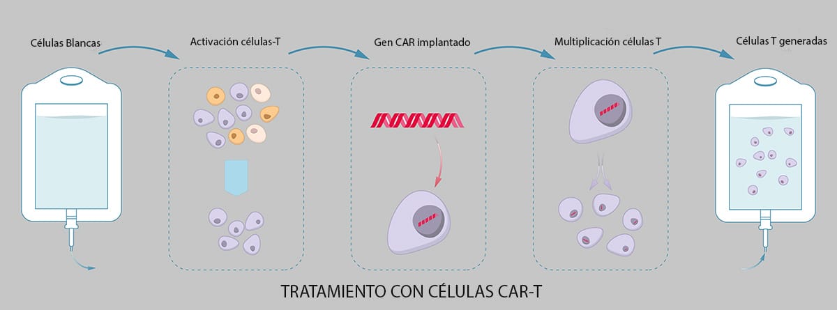 ilustración de Las células T receptoras de antígenos quiméricos (también conocidas como células T CAR) son células T que han sido modificadas genéticamente para producir un receptor de células T artificial para su uso en inmunoterapia.