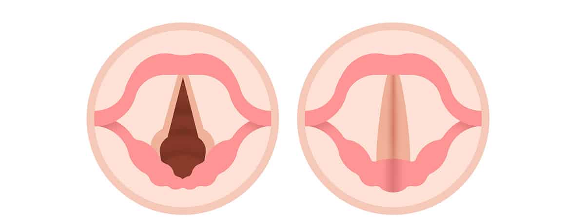 dibujo de estructura de las cuerdas vocales