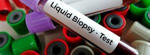 Muestras de sangre para análisis de sangre por biopsia líquida para detectar células cancerosas o fragmentos de ADN que circulan en el torrente sanguíneo