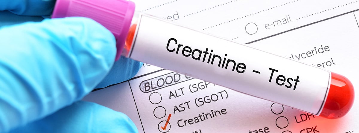 Muestra de sangre para prueba de creatinina, diagnóstico de enfermedad renal.