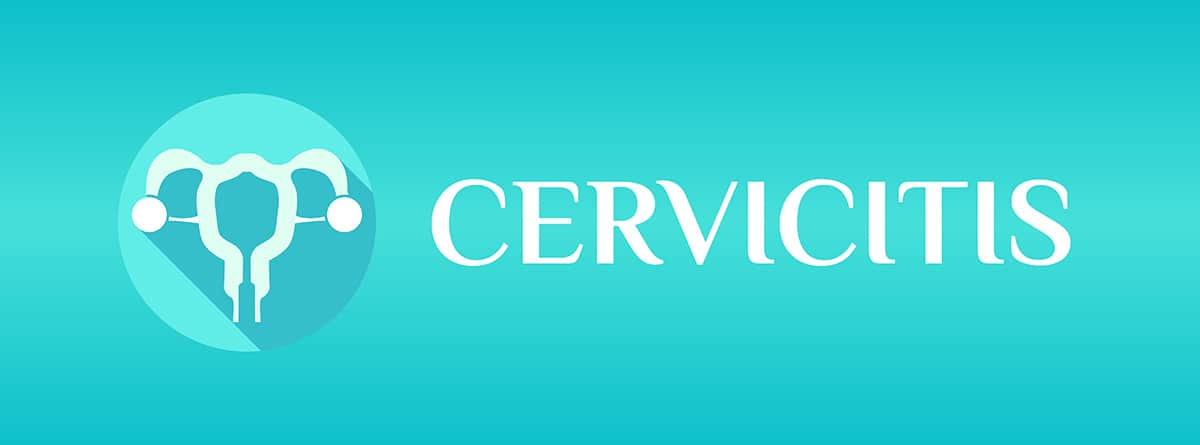 Ilustración cartel de cervicitis
