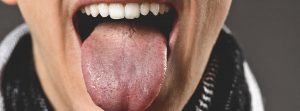 Puntos rojos en la lengua: hombre con la lengua fuera llena de puntos rojos