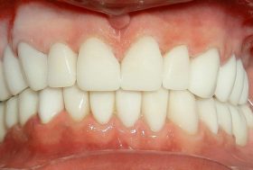 Sonrisa en el dentista