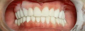 Sonrisa en el dentista