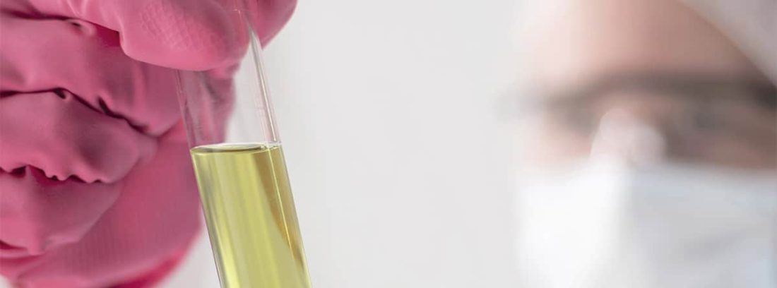 Pruebas de laboratorio