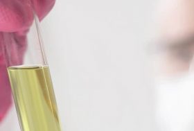 Pruebas de laboratorio
